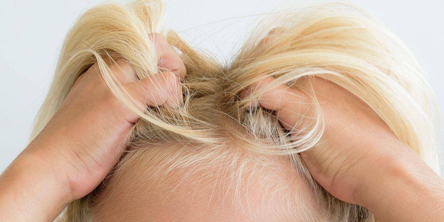 how to get rid of lice fast