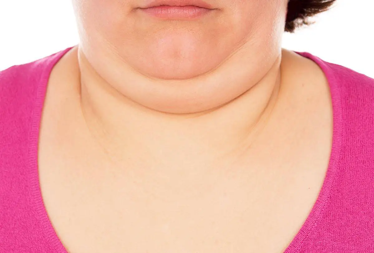 How To Get Rid Of A Double Chin- 3 Best Ways