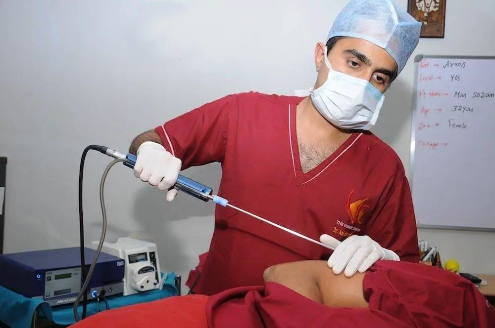 liposuction cost