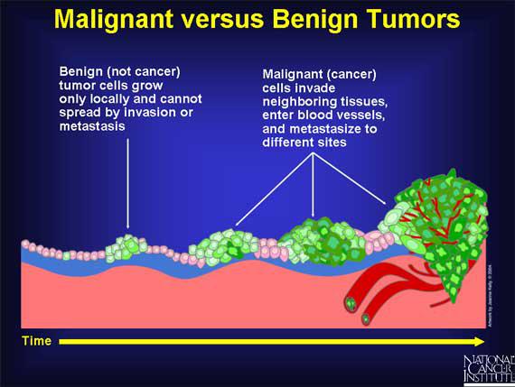 how does cancer kill you