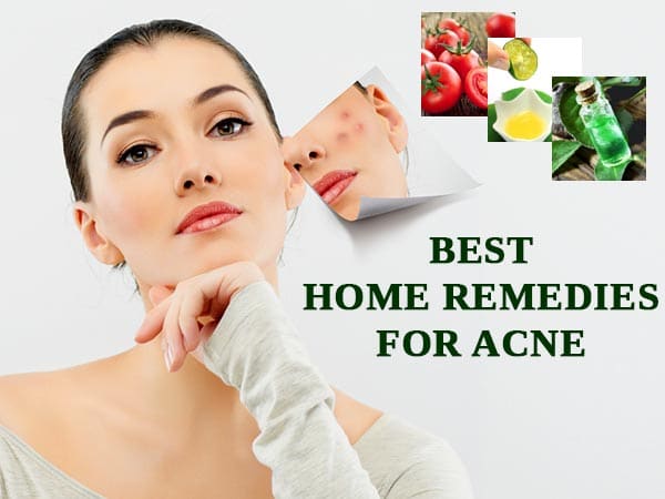 fungal acne treatment