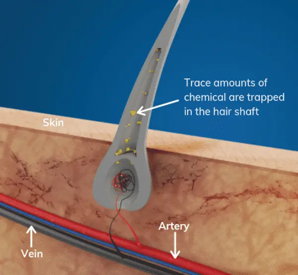 hair follicle test