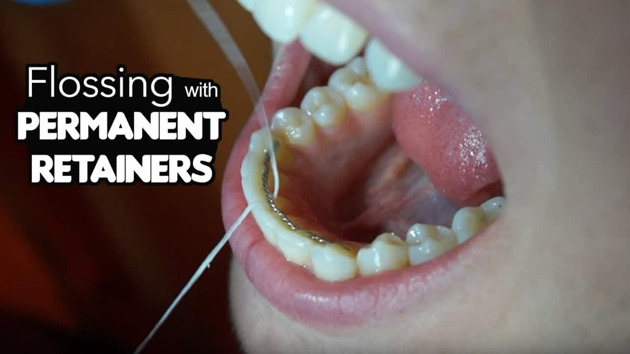 how to clean retainers