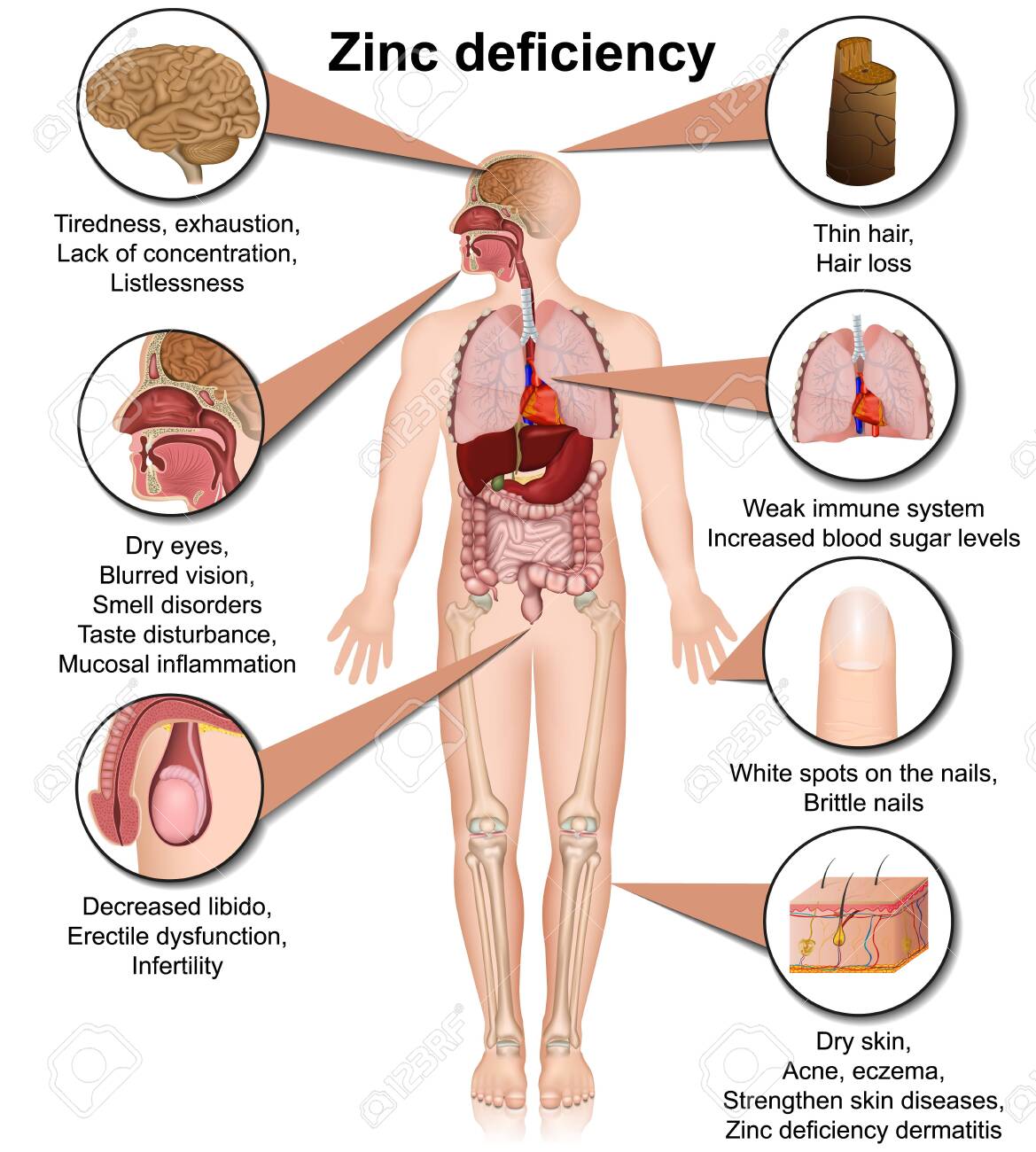 Sudden Loss of Taste and Smell