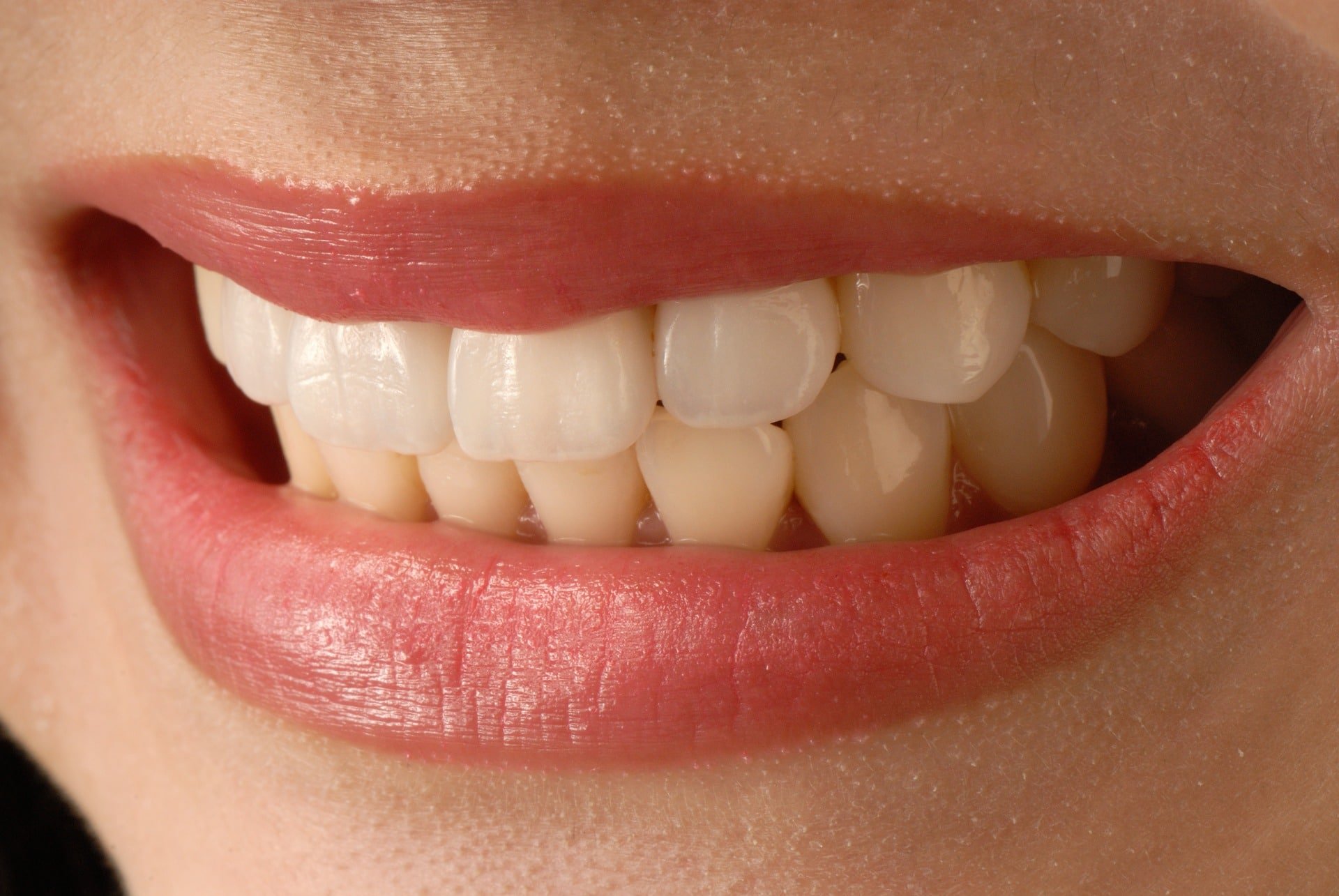 How Much Do Veneers Cost? | The Price To Transform Your Smile