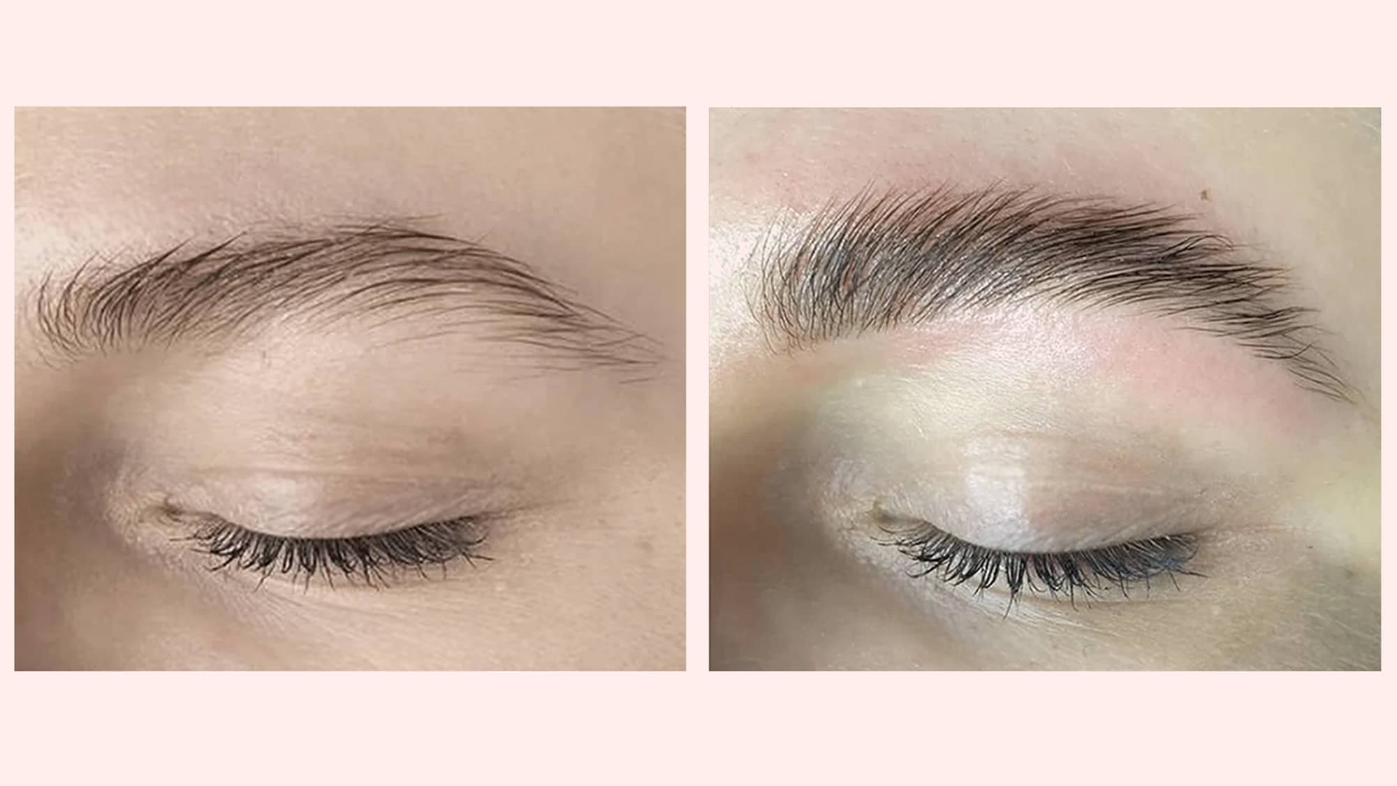 brow lamination