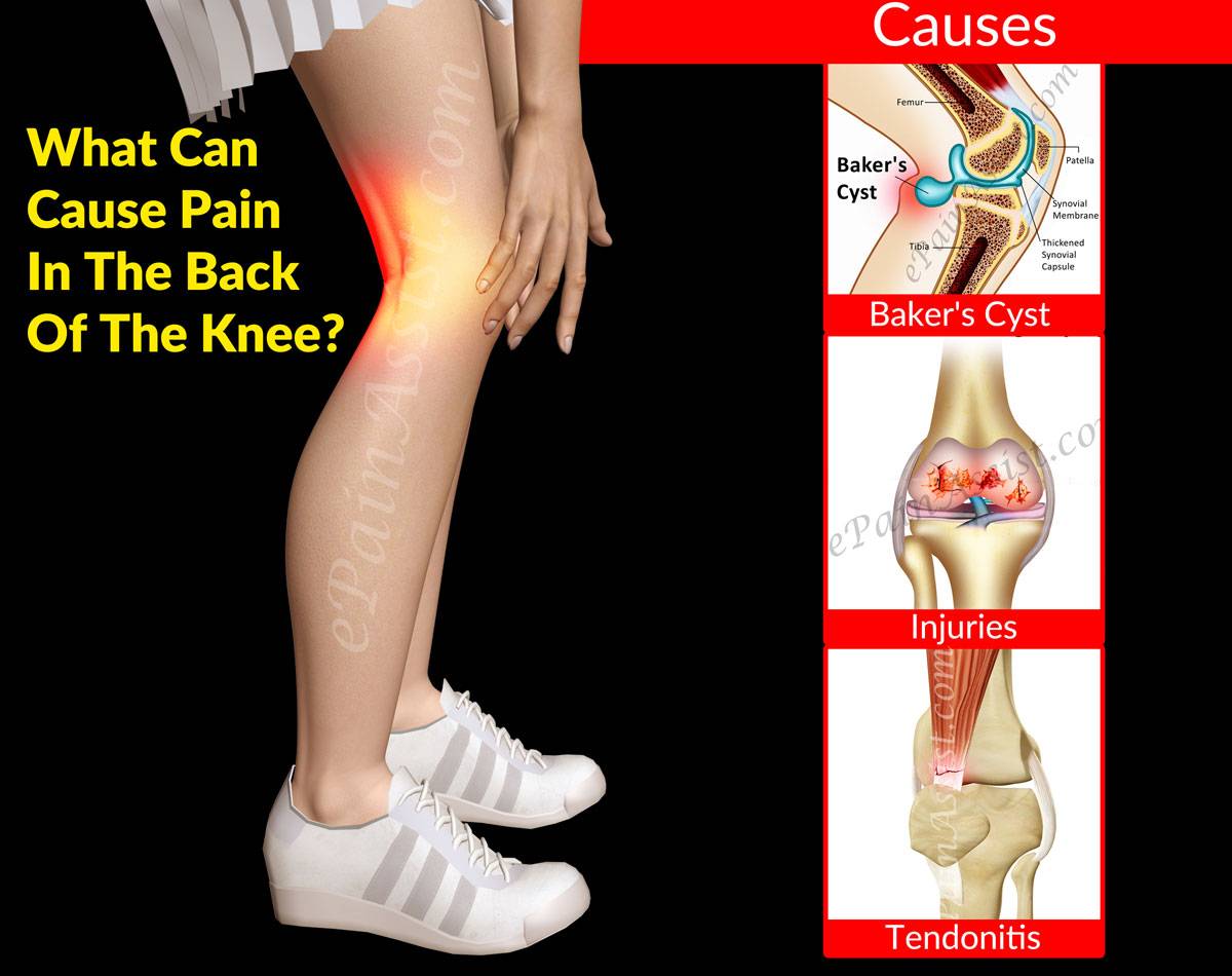 back of knee pain