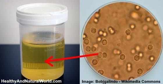 nitrite in urine