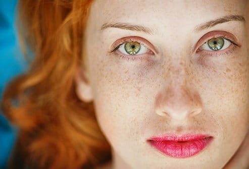 red hair green eyes