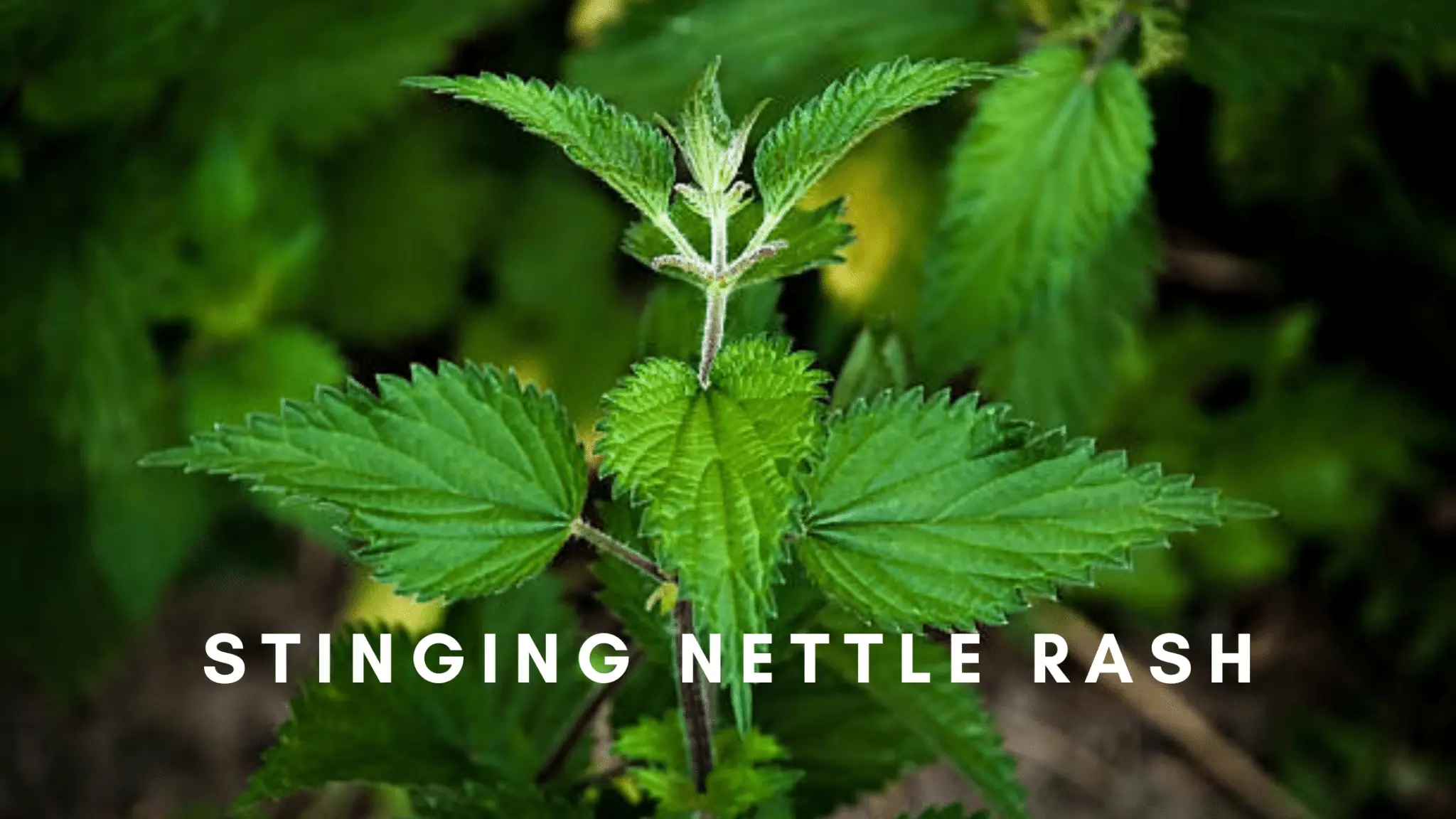Stinging Nettle Rash – Symptoms, Risks and Treatment
