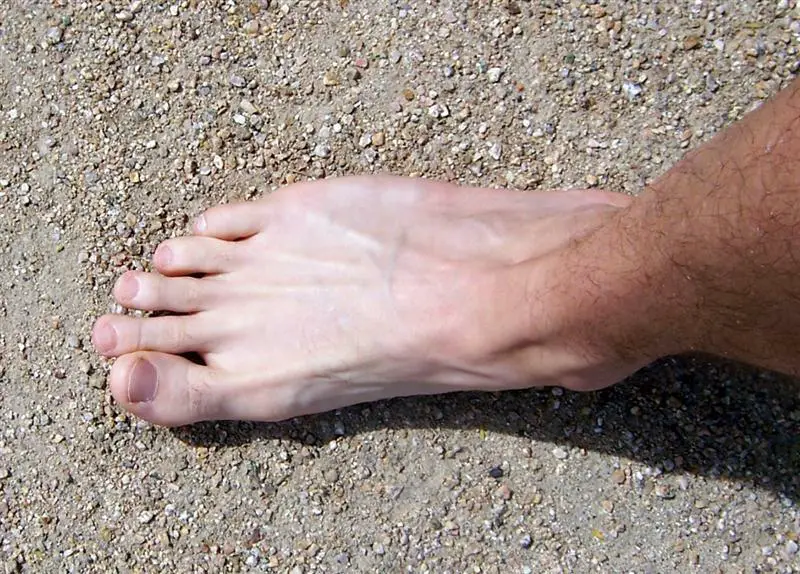 second toe longer than the big toe