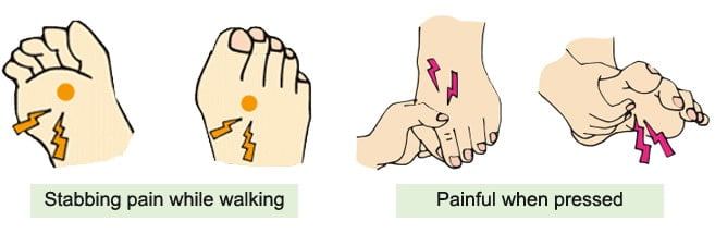 Second Toe Pain 9 Causes With Best Treatments Sleck