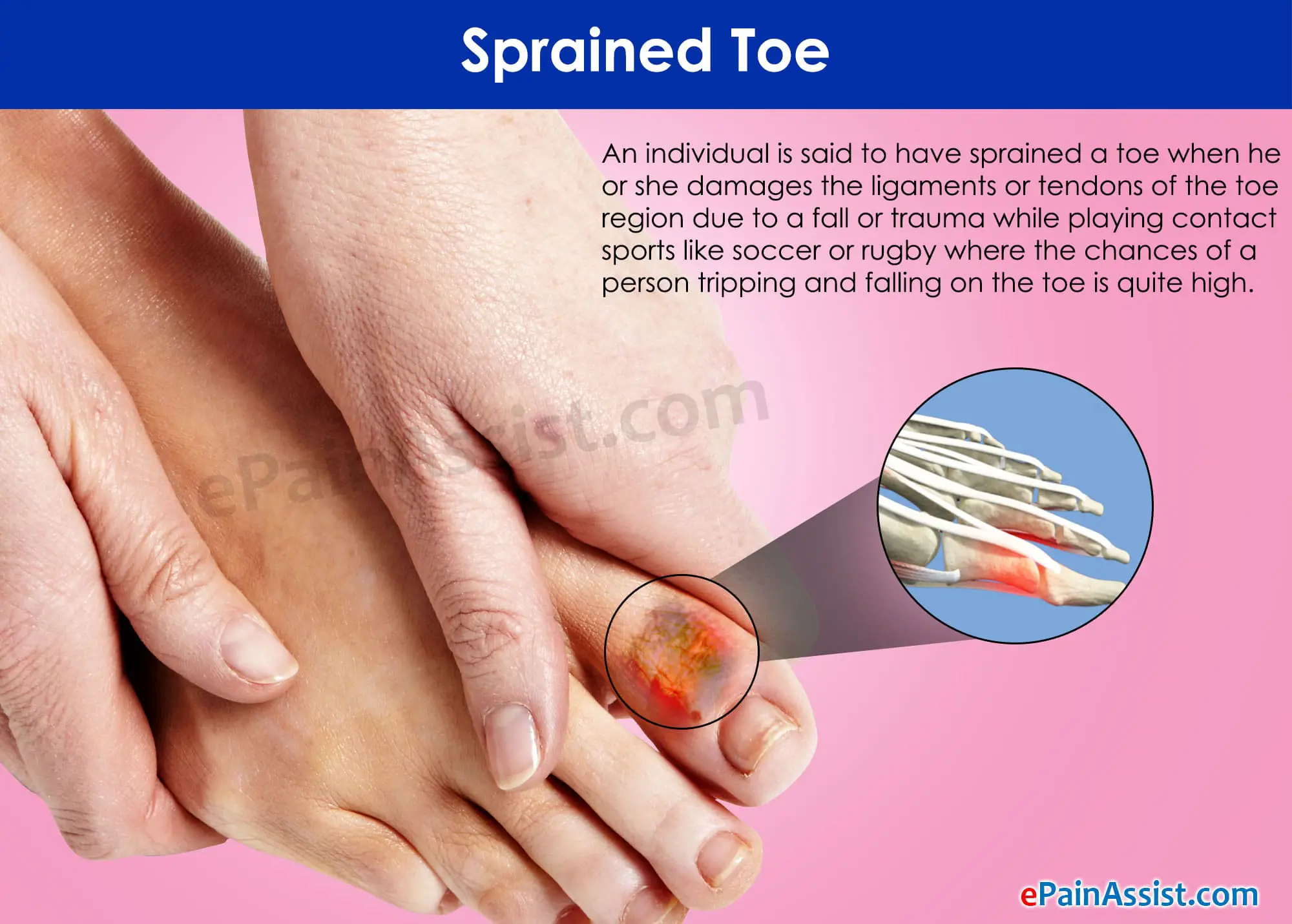 second toe pain
