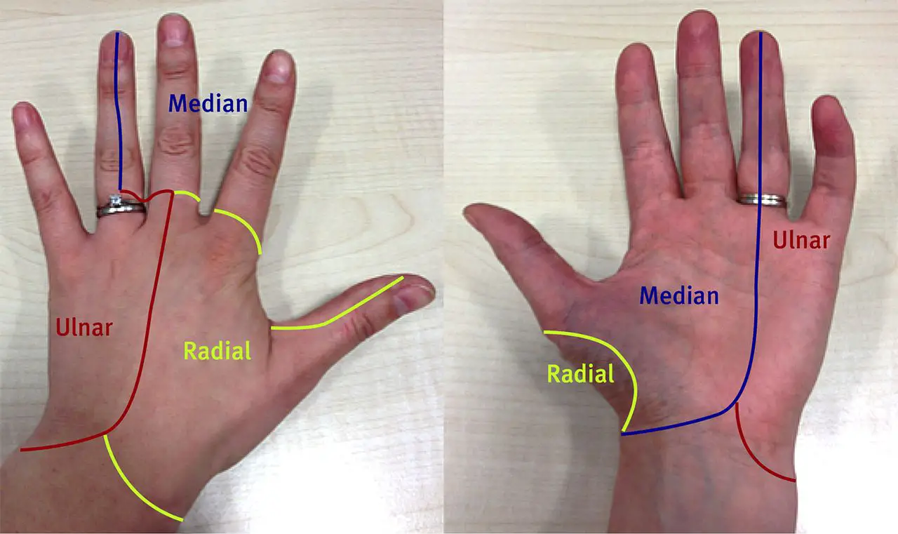 numbness in hands while sleeping