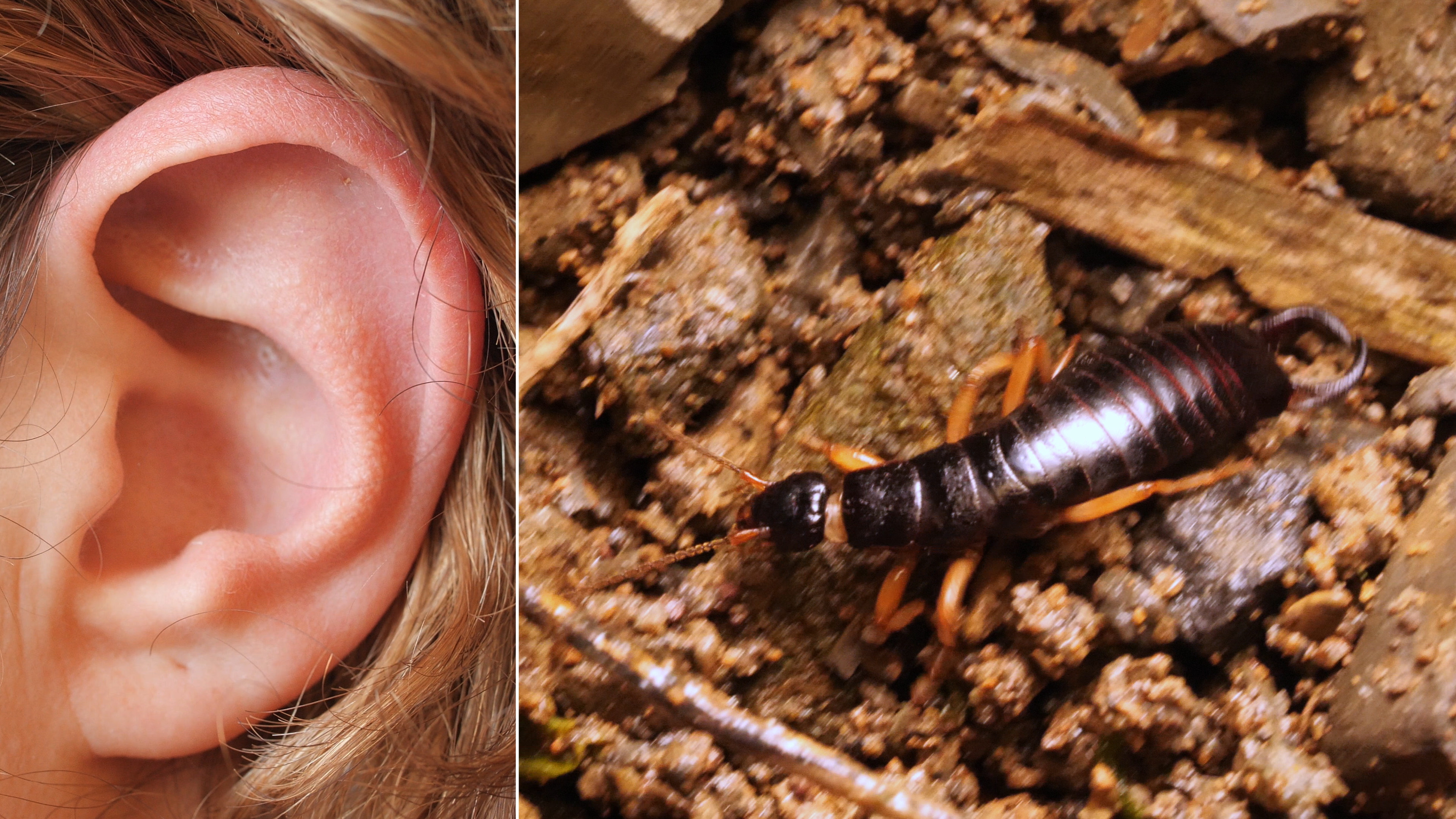 Do earwigs bite