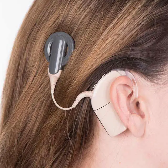 cochlear implant cost