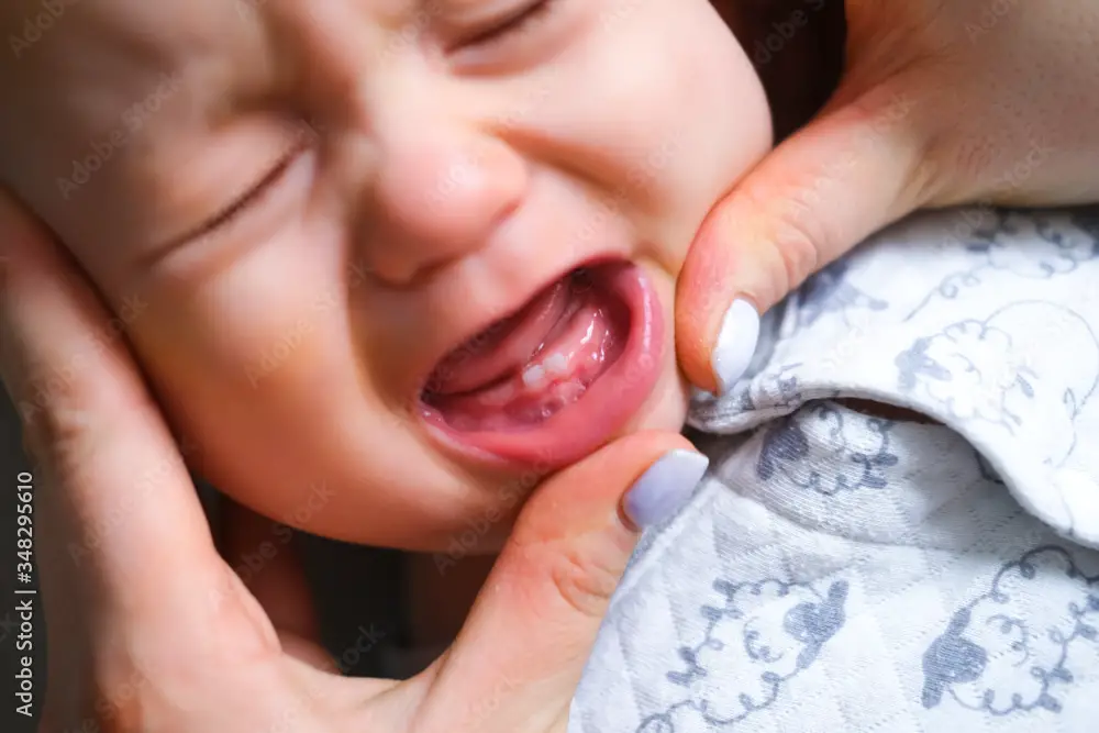 Do Babies Sleep More When Teething