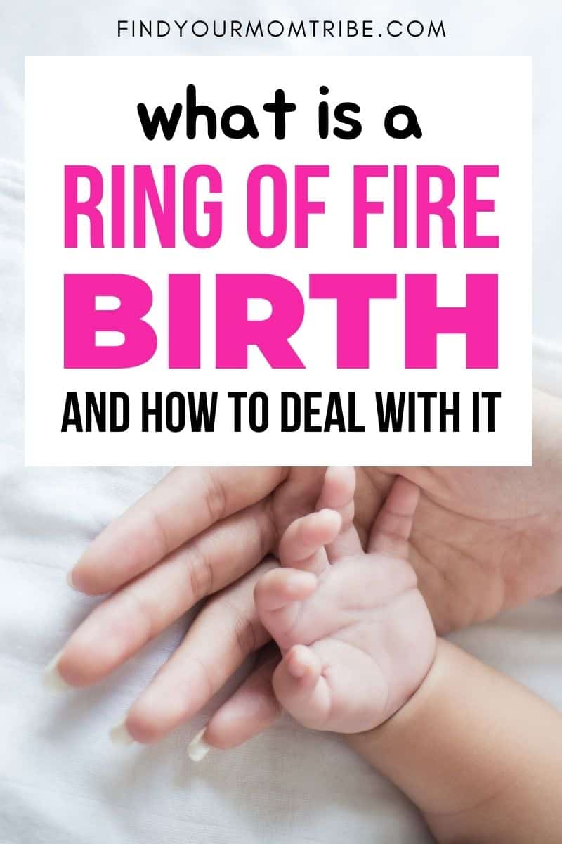 What is the Ring of Fire Birth: 7 Essential Tips to Prepare for it before Delivery!